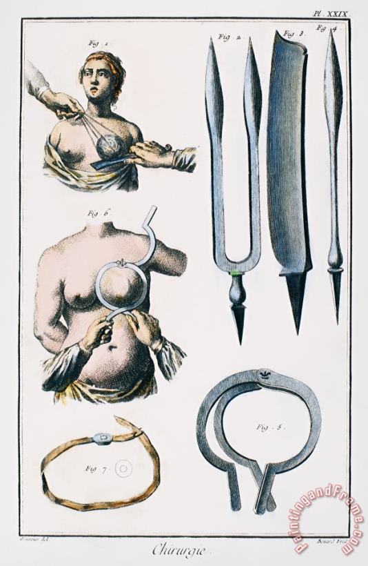 Others Breast Surgery Art Print