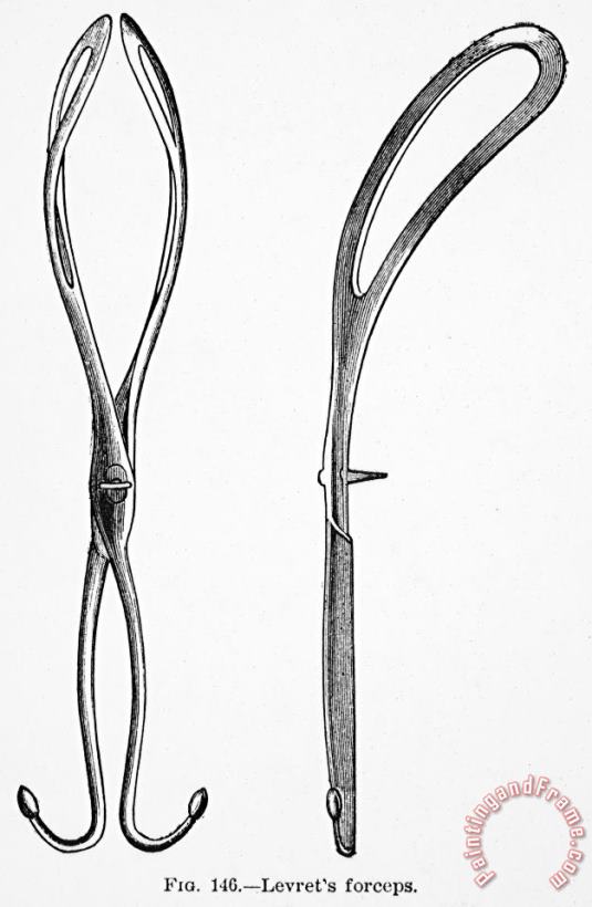 Others CHILDBIRTH: FORCEPS, c1880 Art Painting