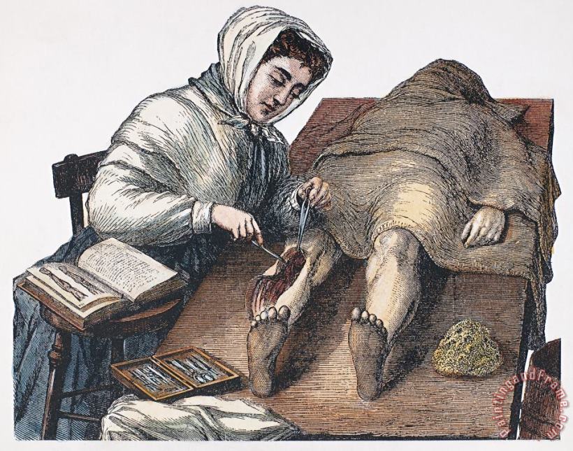 Others DISSECTION, 19th CENTURY Art Print