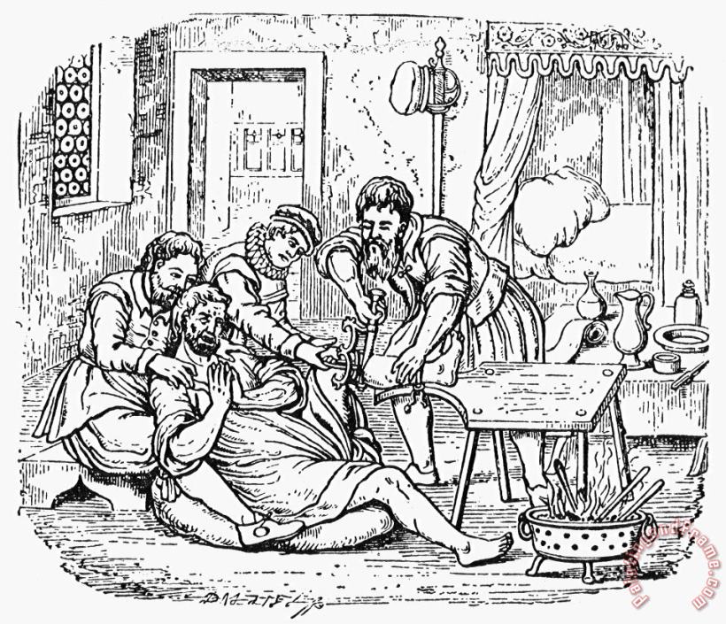 Others Home Amputation, 1592 Art Painting