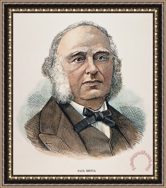 Others Paul Broca (1824-1880) Framed Print