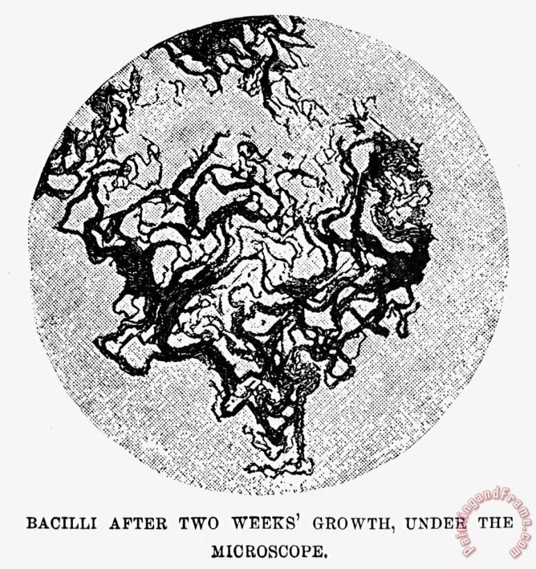 Robert Koch: Bacilli painting - Others Robert Koch: Bacilli Art Print