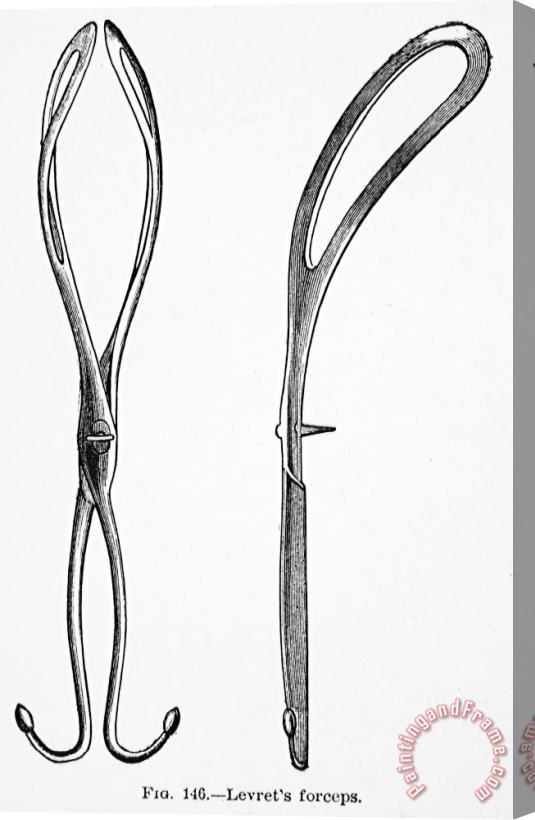 Others CHILDBIRTH: FORCEPS, c1880 Stretched Canvas Print / Canvas Art